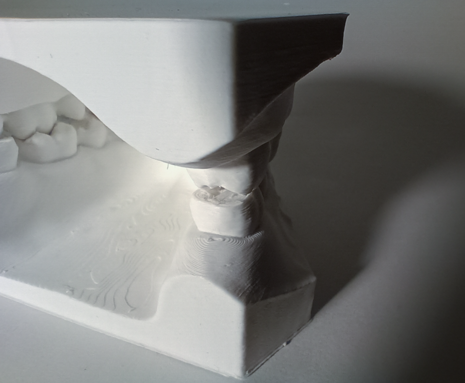 Tooth model Thumbnail