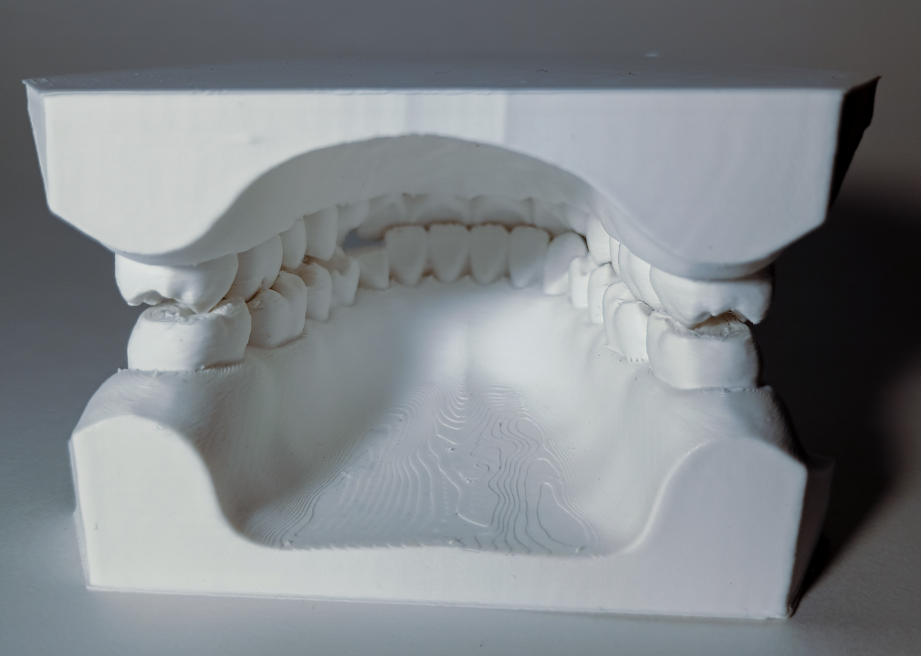 Tooth model Thumbnail
