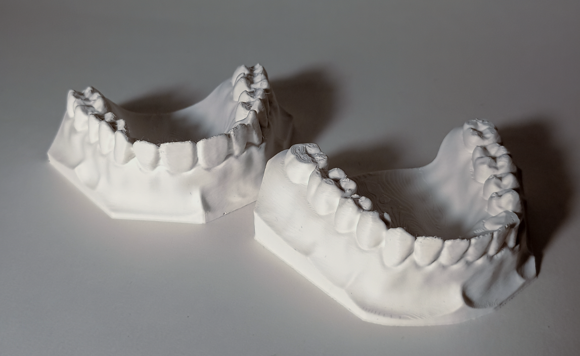 Tooth model Thumbnail